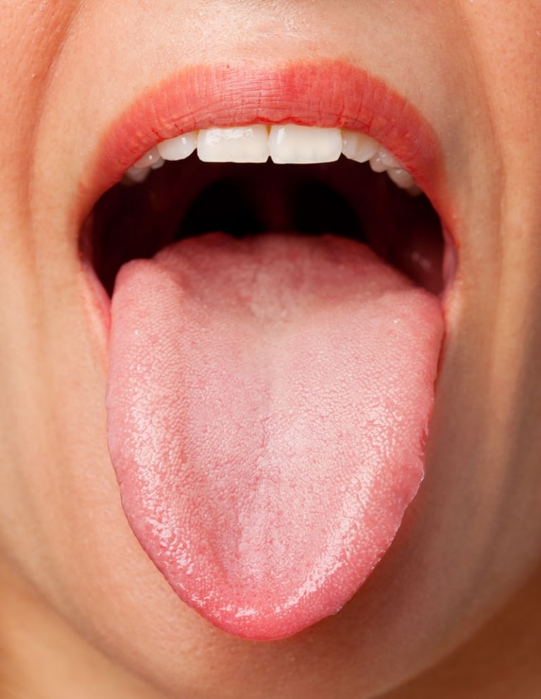 8 Tips For Treating Dry Mouth RCCD Raleigh Dentist